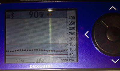 Dexcom Glucose Reading